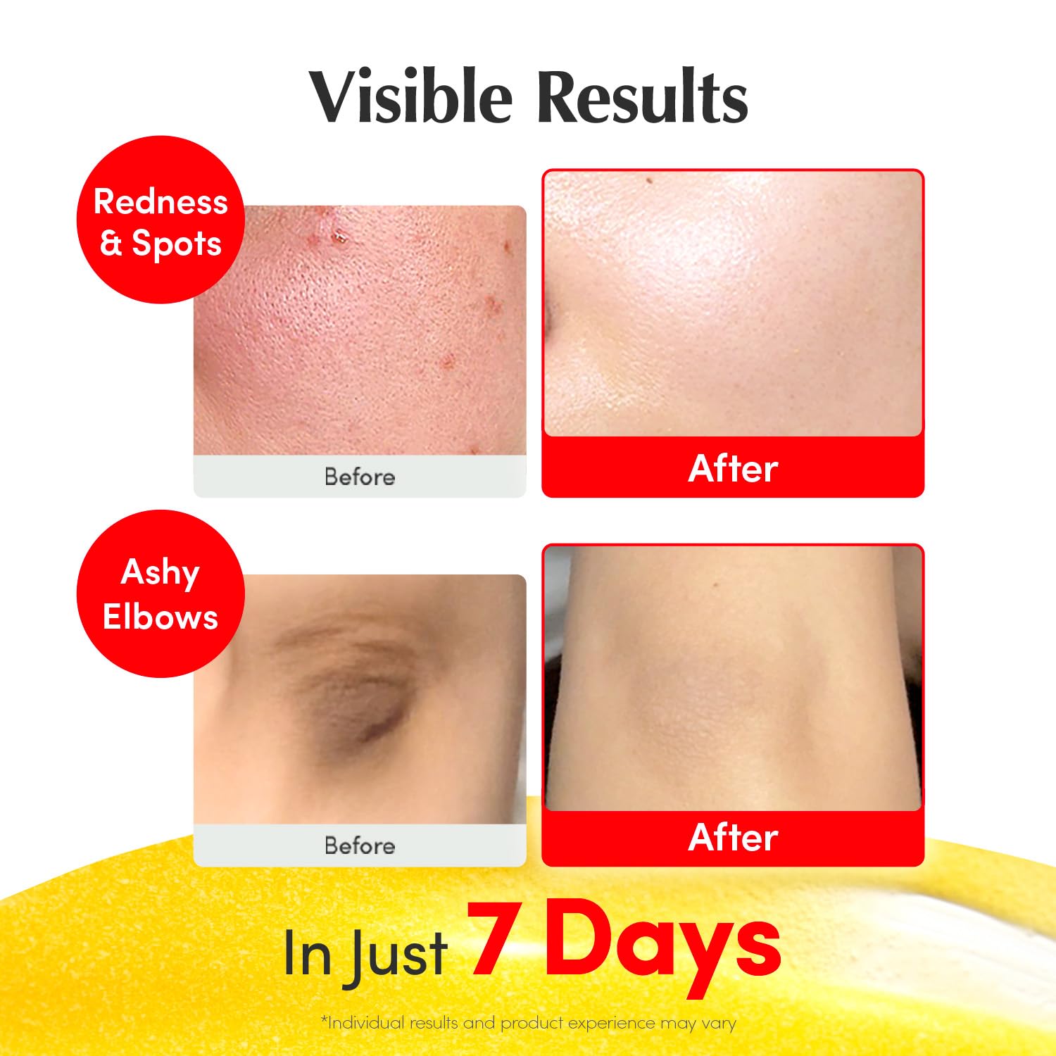 Old World Hub EQQUALBERRY Vitamin Illuminating Serum with Niacinamide, Vitamin C, Hyaluronic Acid, and Vitamin E for brightening and dark spot care