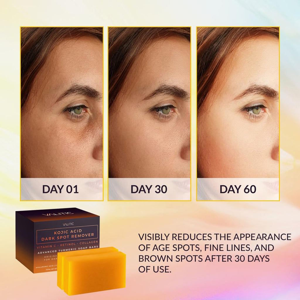 Old World Hub Valitic Kojic Acid dark spot remover soap bars with Vitamin C, Retinol, Collagen, turmeric, infused with hyaluronic acid.